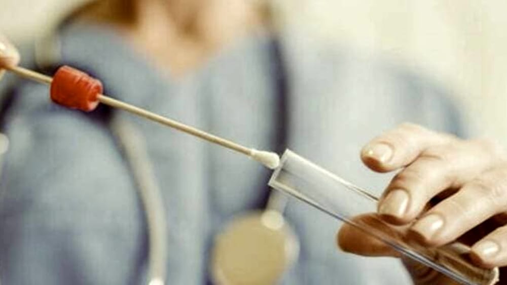 tampone-coronavirus-2