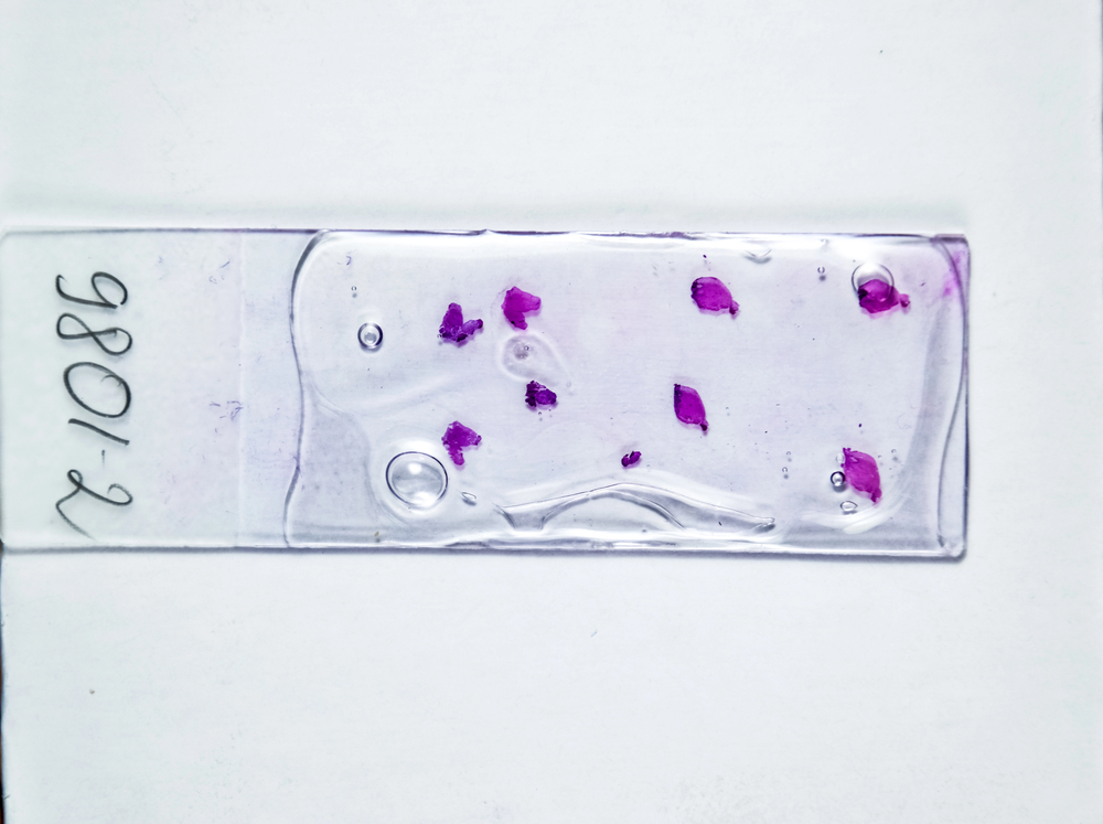 Asp di Trapani, concorso per dirigenti di Patologia Clinica: sei posti rimangono vacanti